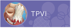 TPVI